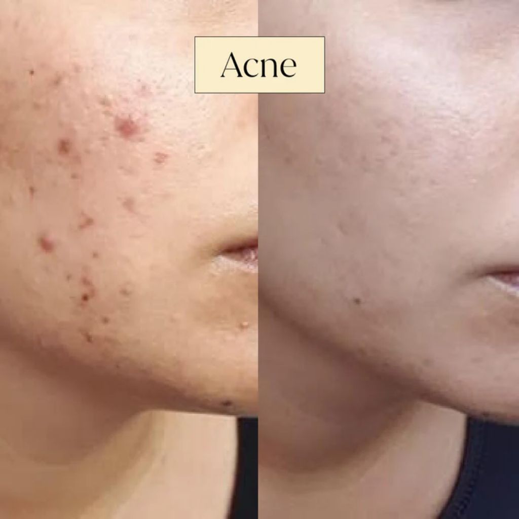 Smooth Skin Scrub 140ml